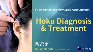 YNSA Yamamoto New Scalp Acupuncture: Demonstration of Hoku Diagnosis & Acupuncture Treatment