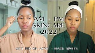 MY AM & PM SKINCARE ROUTINE 2022 | GET RID OF ACNE & HYPERPIGMENTATION