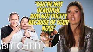 Candice was BULLIED For Her Mountain-Like Nose (Before & After) | Botched | E!