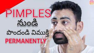 Get Rid of Pimples & Acne Permanently in 2 Steps (Works 100%) | Fit Tuber Telugu