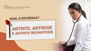 ARTRITE, ARTROSE OU ARTRITE REUMATOIDE?