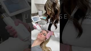 Our Lutronic Ultra Lase treatment is our laser for summer! It’s safe on all skin types, all year!