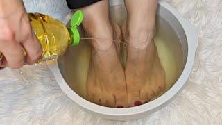 I soaked my feet in APPLE CIDER VINEGAR and 15 minutes later I was shocked at what happened !