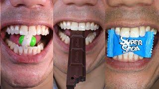 Doctor Tristan Peh Best Viral Chocolate and Candy Chewing Sounds Compilation