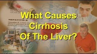 What Causes Cirrhosis Of The Liver?