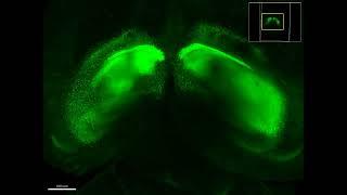 3D-reconstructed cleared brain from a PnTx-Injected Mouse (Post-MWM) (Carmi. I and Bittan M.A)