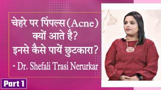 ACNE PROBLEM? Acne Types & Causes | पिंपल्स को करें ख़त्म | Dr. Shefali | BVG TV (Part 1)