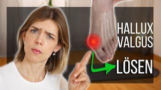 How to stop hallux valgus (and prevent it from getting worse)