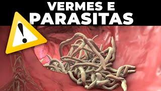 COMO ACABAR COM VERMES E PARASITAS no SEU CORPO - Dr Renato Silveira