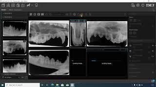 How to Create and Save Layouts for Dental X-Rays in the iM3 Software