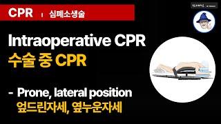 C16 [심폐소생술] 수술중 CPR ... [CPR] Intraoperative CPR