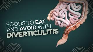 Foods To Eat and Avoid With Diverticulitis