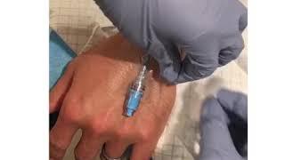 How To Remove An IV Without Hurting A Patient