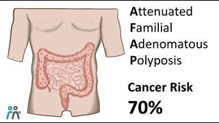 Attenuated- Familial Adenomatous Polyposis