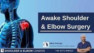 Awake Shoulder and Elbow Surgery