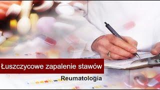 Łuszczycowe zapalenie stawów - przyczyny, objawy, diagnostyka, leczenie, rokowanie