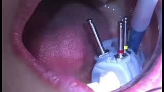 Look, it’s fun: moving your teeth to another location