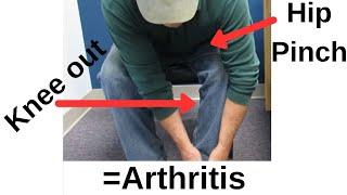 Classic Sign of Hip Arthritis:This is the SIMPLEST test to identify it!