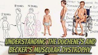 Understanding The Duchene's And Becker's Muscular Dystrophy @umerfarooqbiology7083