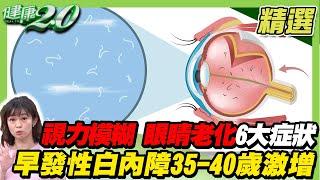 視力模糊 眼睛老化6大症狀！早發性白內障35-40歲激增！【健康2.0精選】