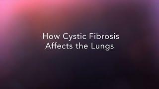 How Cystic Fibrosis Affects the Lungs