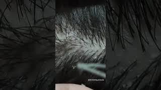 Relaxing dandruff removal #oddlysatisfying #relaxing #satisfying #asmr