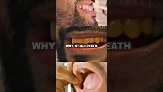 Zuniga on 3 Steps To ELIMINATE Bad Breath