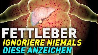 Fettleber: Diese Symptome NIEMALS ignorieren!