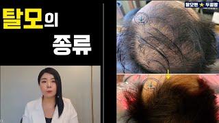 수원탈모 두피밥에서 알려드리는 "탈모의 종류" Korean scalp care