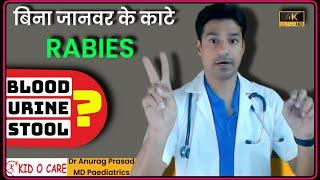 बिना कुत्ता काटे रेबीज हो गया | Non Bite RABIES by Dr Anurag Prasad (HIndi)