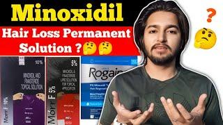 Minoxidil Is A Permanent Solution of Hair Loss and Baldness ? | Sahil Nagpal