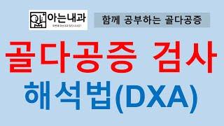 #2 골다공증 검사 해석법(feat. DXA T점수? Z점수?)