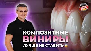 Почему композитные виниры лучше не ставить, меняем композит на керамику. Красивые виниры в Москве.