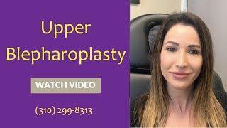 Upper Blepharoplasty -- Dr. Mehryar Taban--  CALL 310-299-8313