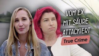 Säure-Angriff überlebt: Wie Vanessa nach der Attacke zu sich selbst fand