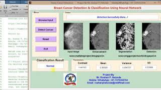 Breast Cancer Detection & Classification using Neural Network Matlab Project with Source Code