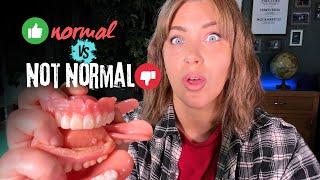 Dentures: What's Normal vs  Not Normal