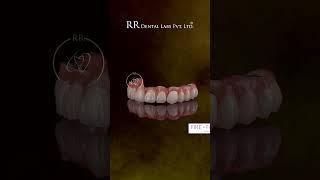 RR Dental Labs  Inside India’s Digital Dental Tech Hub  Precision, Speed & Innovation