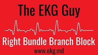 Right Bundle Branch Block (complete) on EKG / ECG l The EKG Guy - www.ekg.md