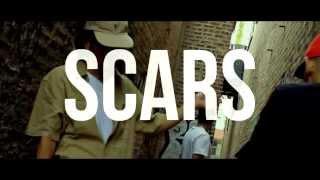 Scars - CCG AON Exclusive / Prod & Shot by @DjKenn_AON