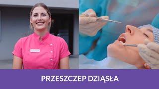 Co zrobić przy zaniku kości oraz dziąsła? Rekonstrukcja brakującego dziąsła