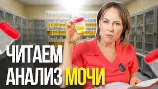 Учимся понимать анализ мочи! Общий анализ МОЧИ, РАСШИФРОВКА АНАЛИЗА