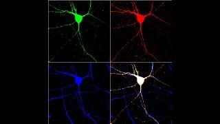 Serotonin Release/Balancing Frequency