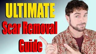 Scar Removal Products That Work | ULTIMATE Product Guide | Chris Gibson