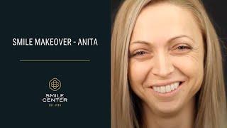 Smile Makeover - Anita - SmileCenter Budapest