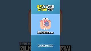 안 아픈 충치? 더 위험합니다...#충치 #임플란트 #충치치료