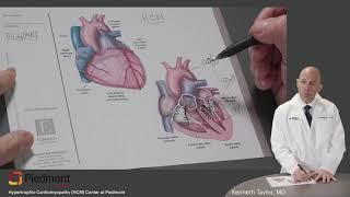 Hypertrophic Cardiomyopathy - Patient’s Guide for Better Understanding