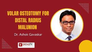 Volar osteotomy for distal radius malunion - Dr. Ashok Gavaskar