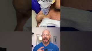 Derm reacts to super satisfying nose pimple pops! #dermreacts #dictorreacts #pimplepop