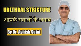 Urethral Strictures in 2021 .आपके सवालों के जवाब।  क्या नया है ? Success rate of urethral surgery